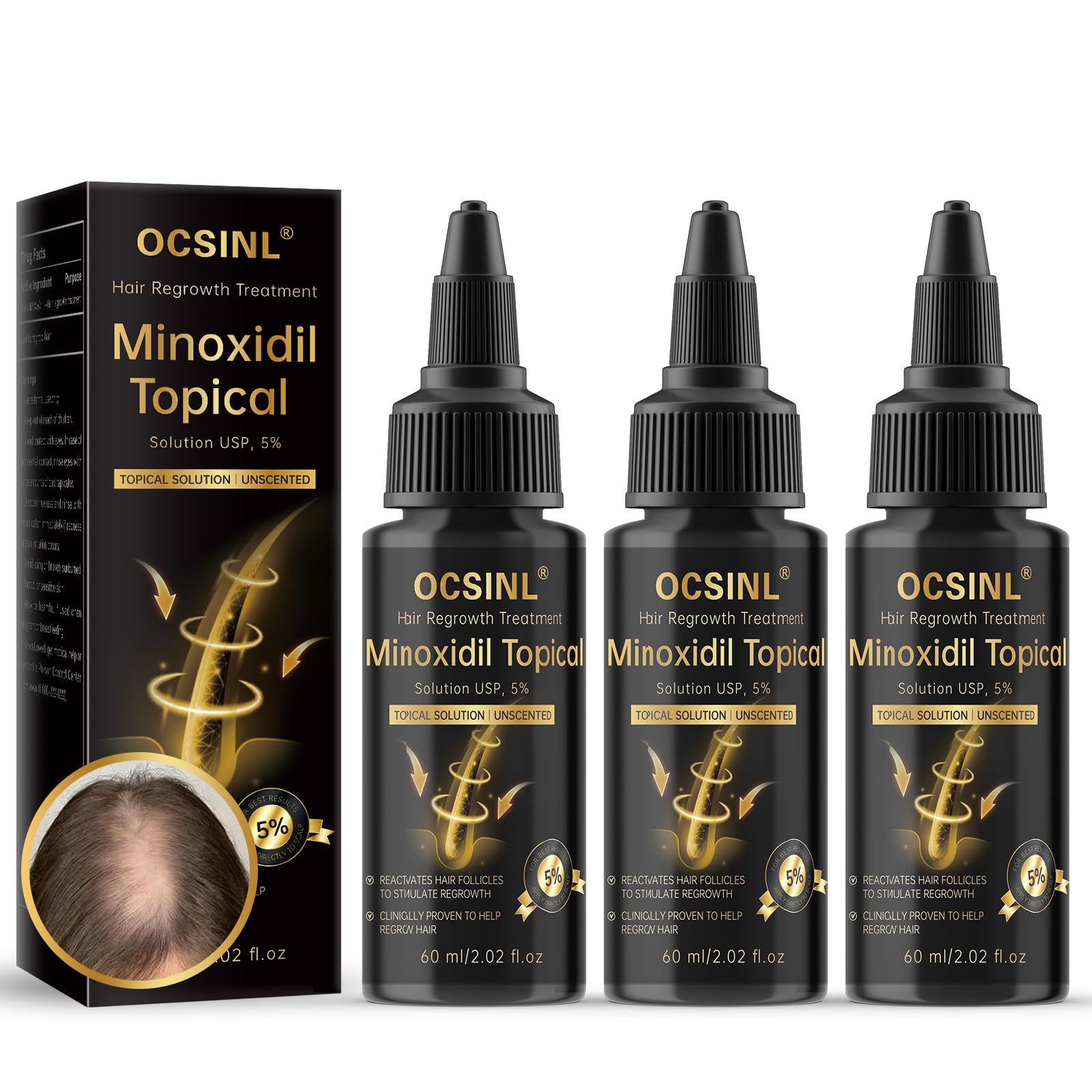 OCSINL minoxidil bottle with precision dropper for targeted scalp application.