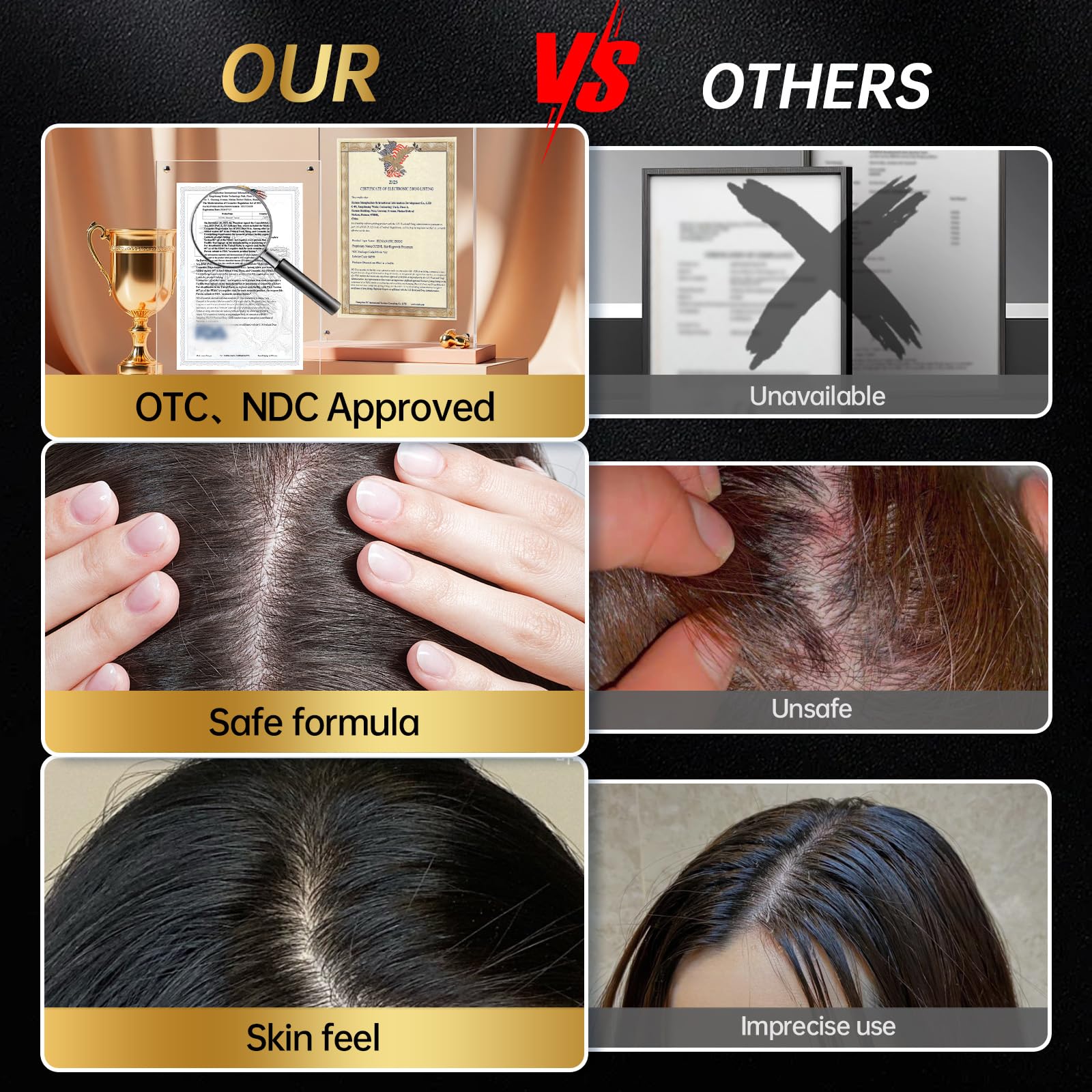 OCSINL minoxidil dispensing action demonstrating direct root application.