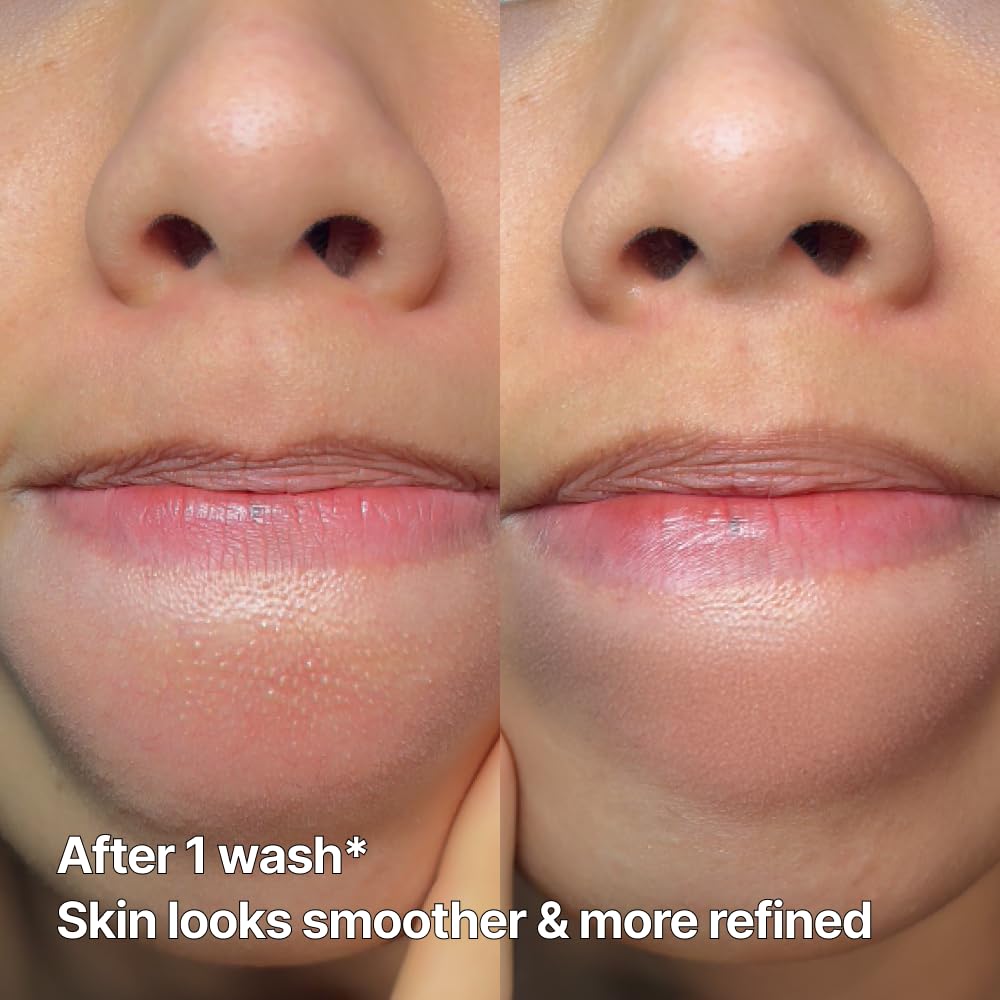 ODELOI tea tree and green tea extracts purify while maintaining moisture