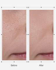 DERX Cleanser creating creamy lather, balanced and refreshing on skin.