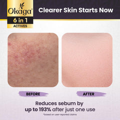 Close-up of Okaga rice complex nourishing skin radiance