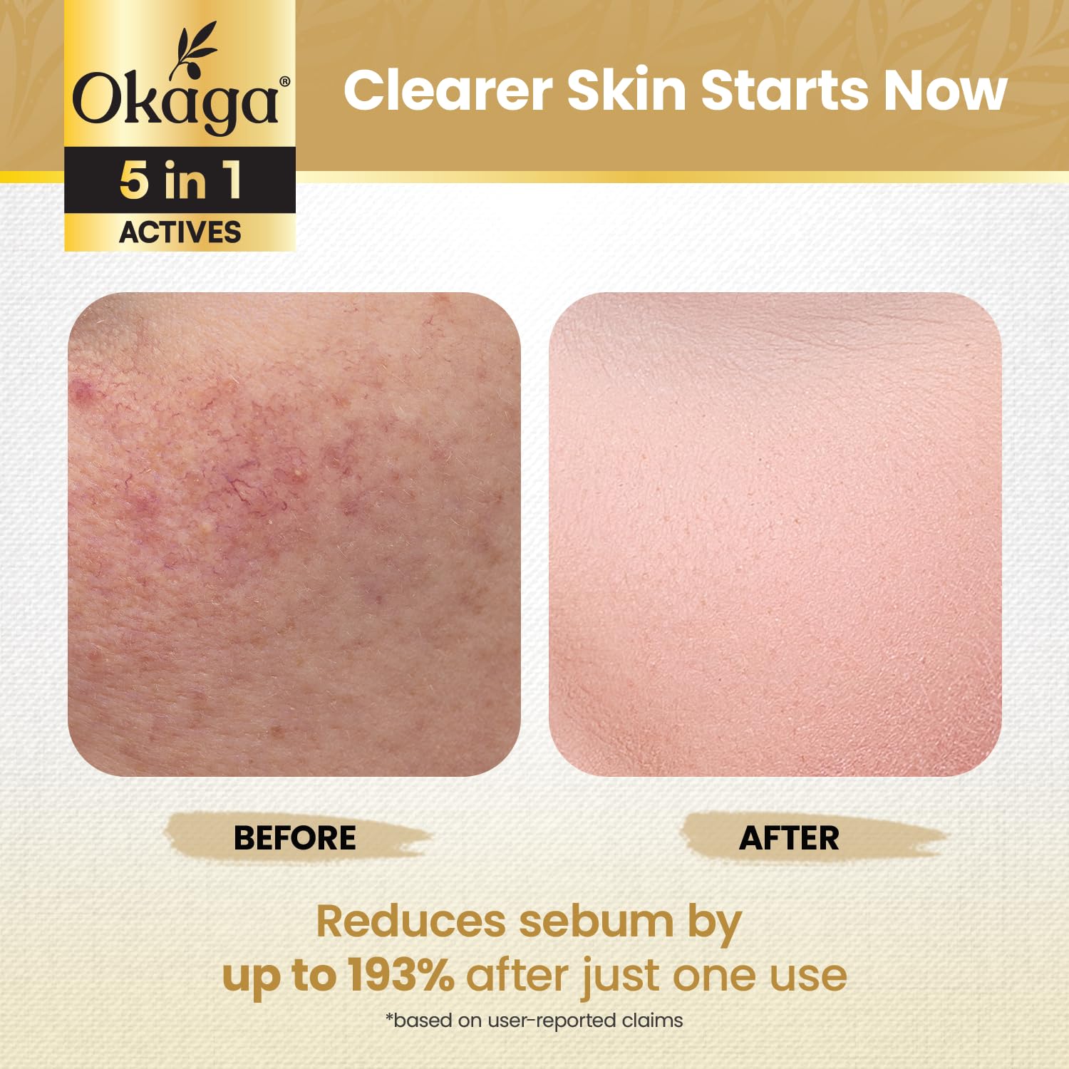 Okaga Rice Peel Shot Ampoule application on hand suggests soothing daily use.