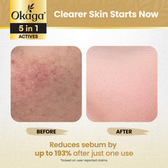 Okaga Rice Peel Shot Ampoule application on hand suggests soothing daily use.