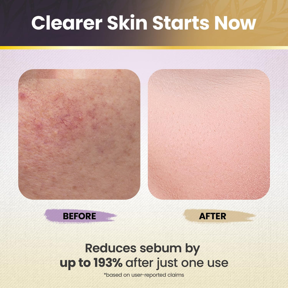 Okaga White Rice Peel Shot daily renewal image showing gentle exfoliation and calm skin.
