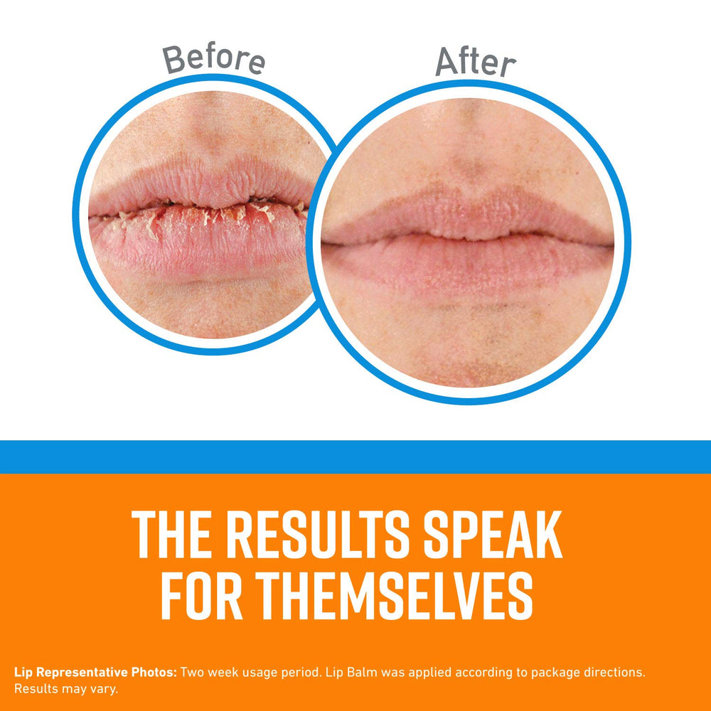 O'Keeffe's Cooling Relief Lip Repair application in use for instant soothing.