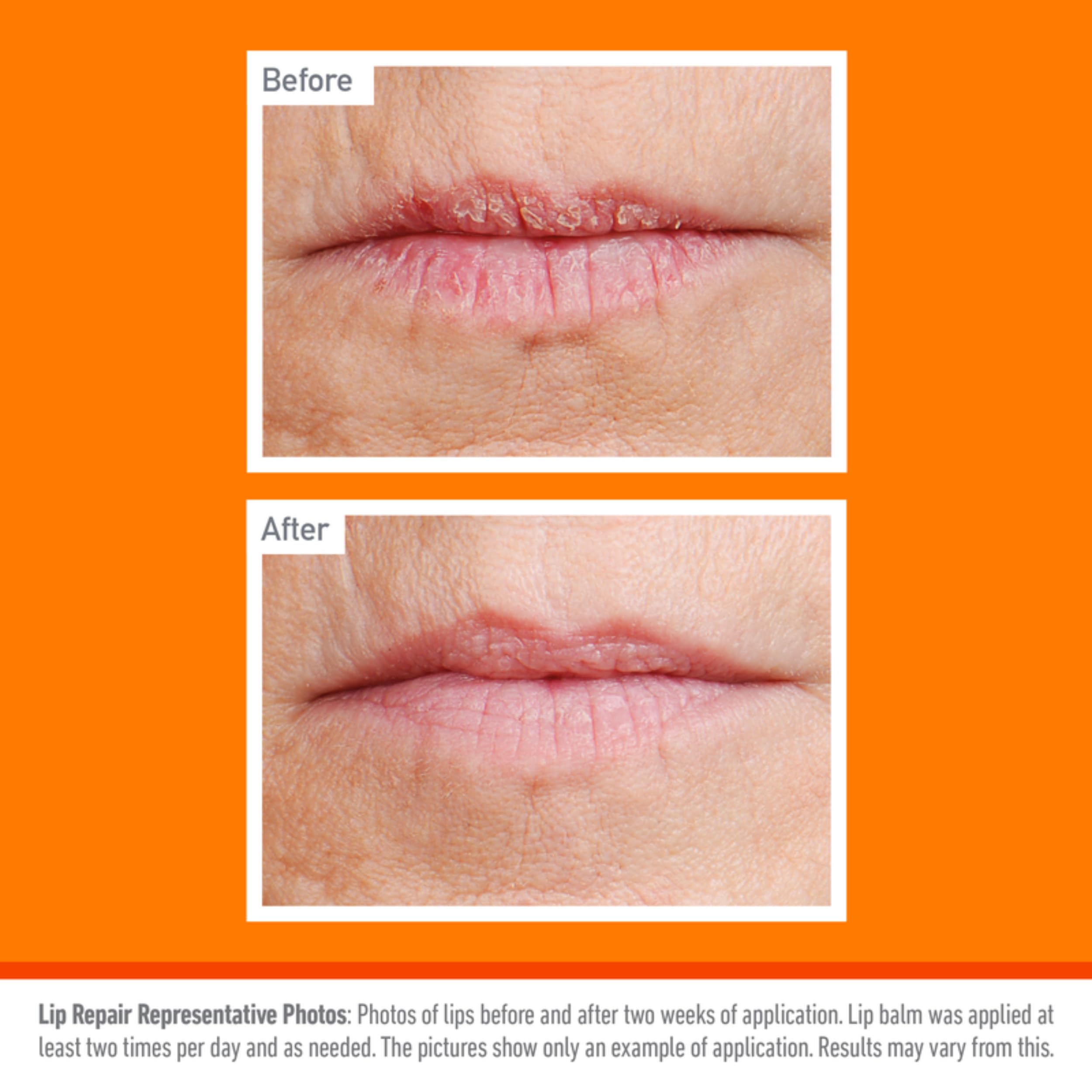 O'Keeffe's Lip Repair moisturizes extremely dry lips with quick absorption