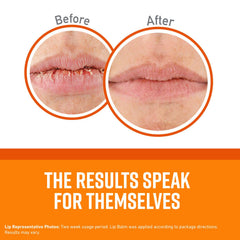 O'Keeffe's Unscented Lip Repair in use, smooth application on lips.