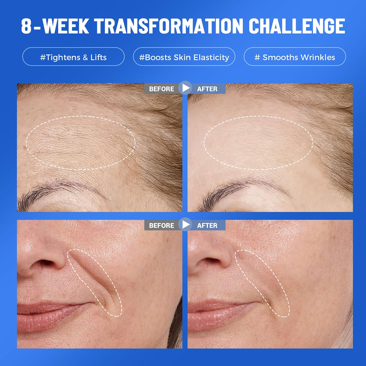 Okela collagen hydrogel mask on face ready for overnight hydration and lifting.