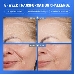 Okela collagen hydrogel mask on face ready for overnight hydration and lifting.