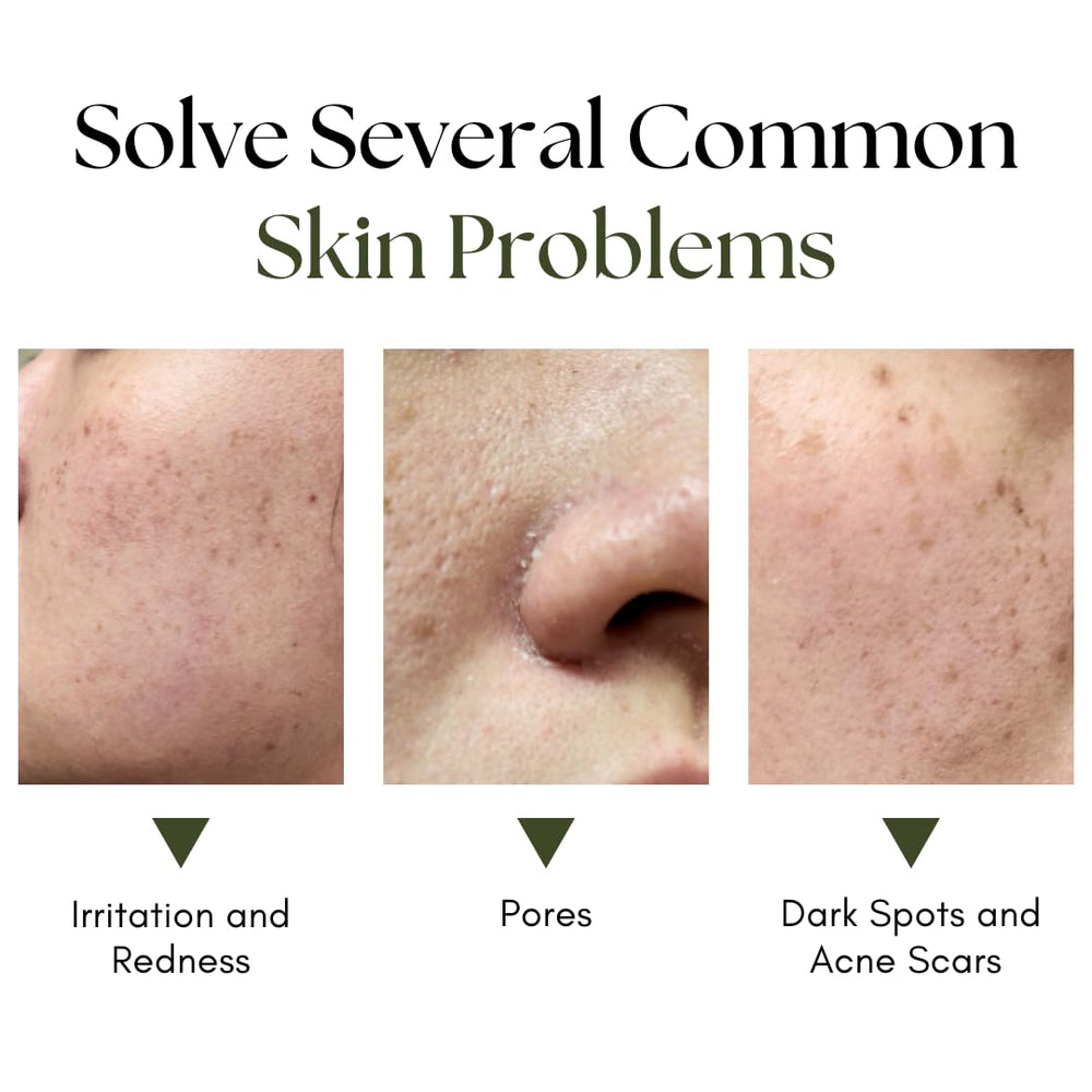 Okra Origins bamboo and burdock extracts highlight soothing skin relief