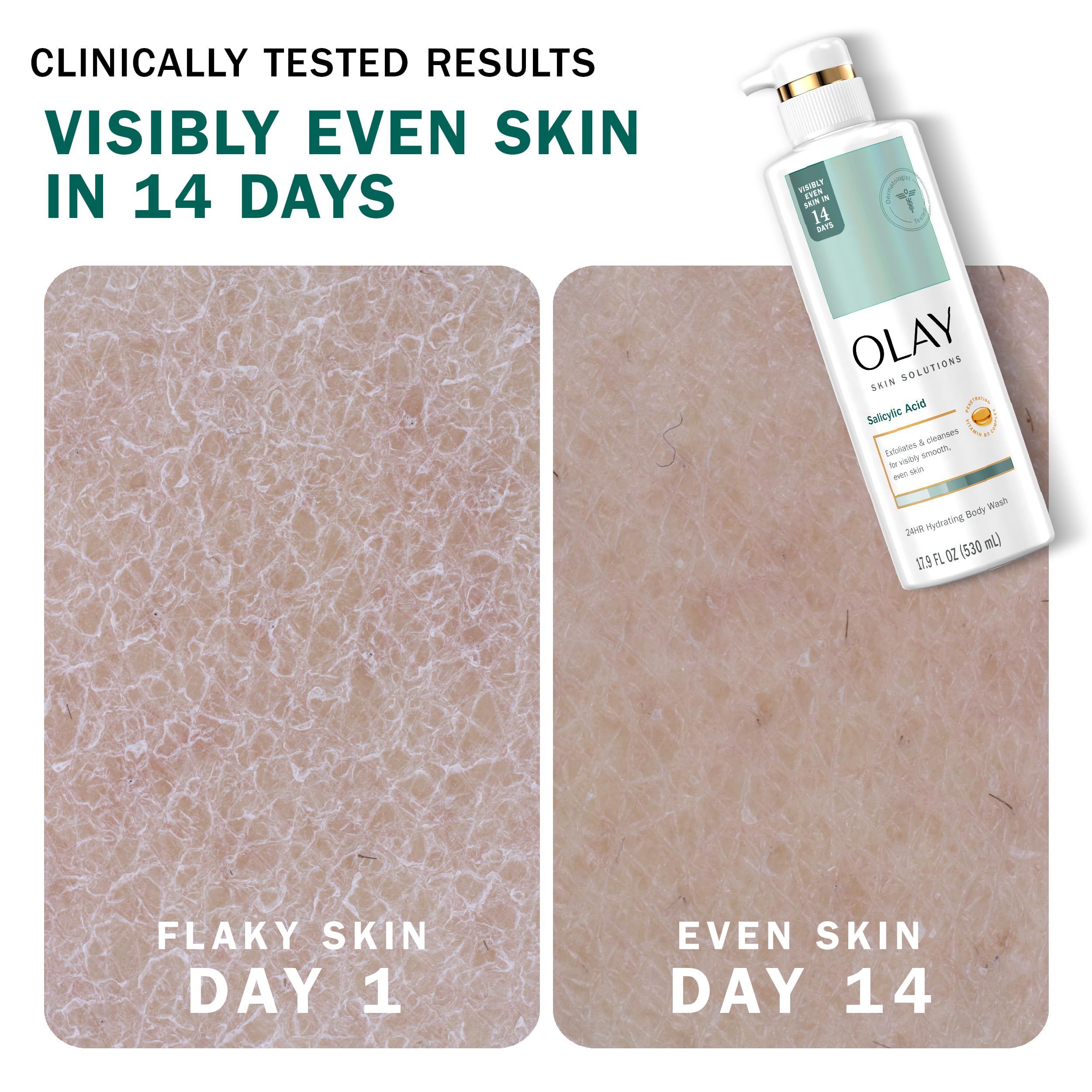 Person examining the Dermatologist-tested logo on Olay bottle.