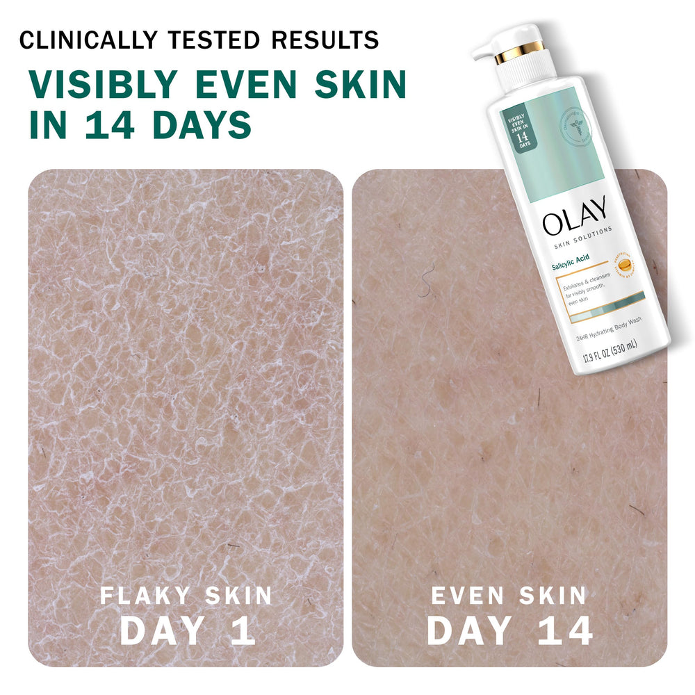 Person examining the Dermatologist-tested logo on Olay bottle.