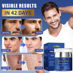 OLELON eye-area treatment application demonstrates targeted care for a brighter look