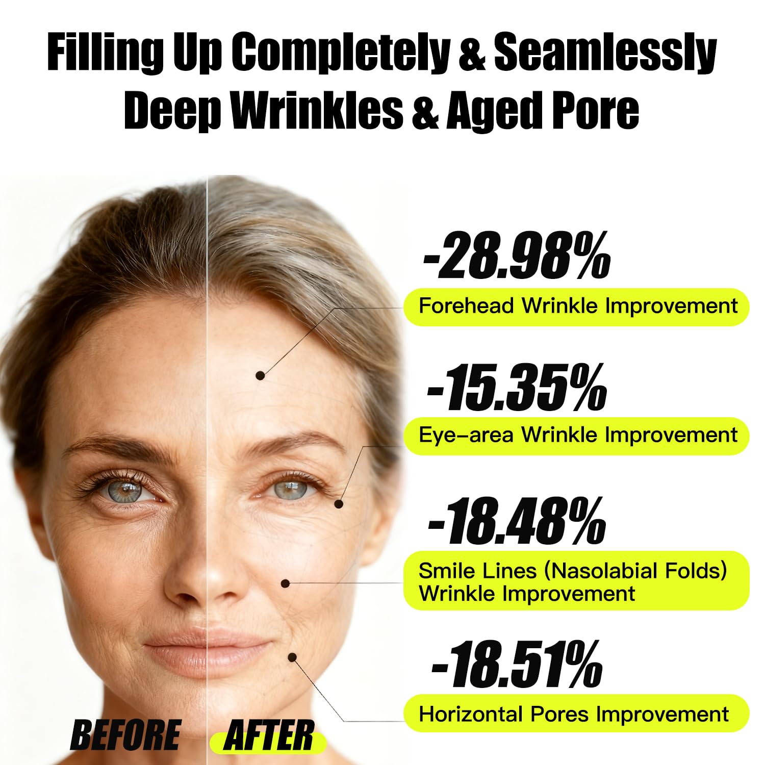 OLELON Peptide complex supports subtle lift and contour