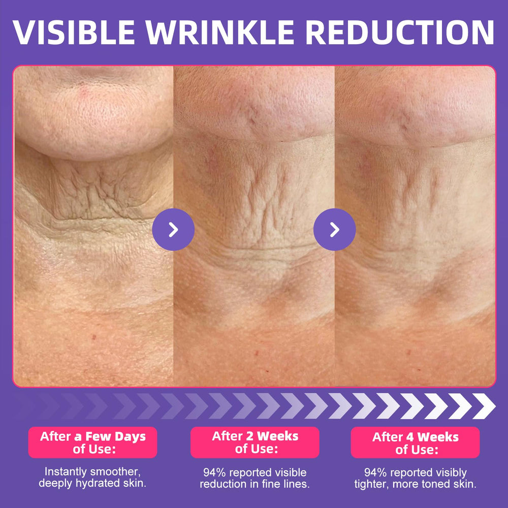OLELON radiant neck skin image suggests even tone and vitality.