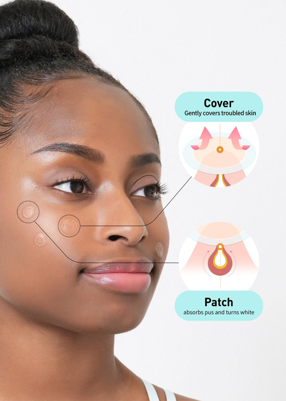 OLIVE YOUNG Care Plus Spot Patch applied to a blemish on skin
