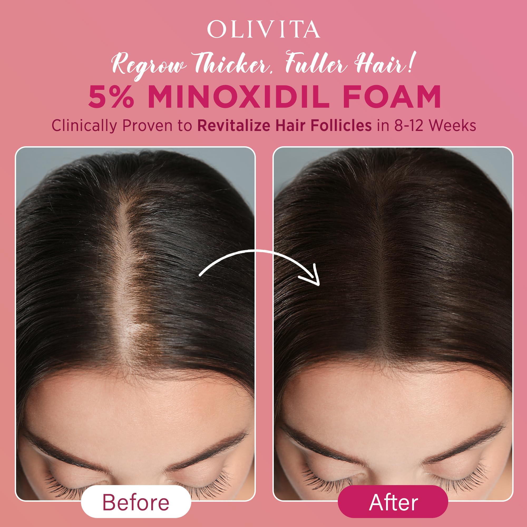 OLIVITA shows thicker-looking hair with consistent use.