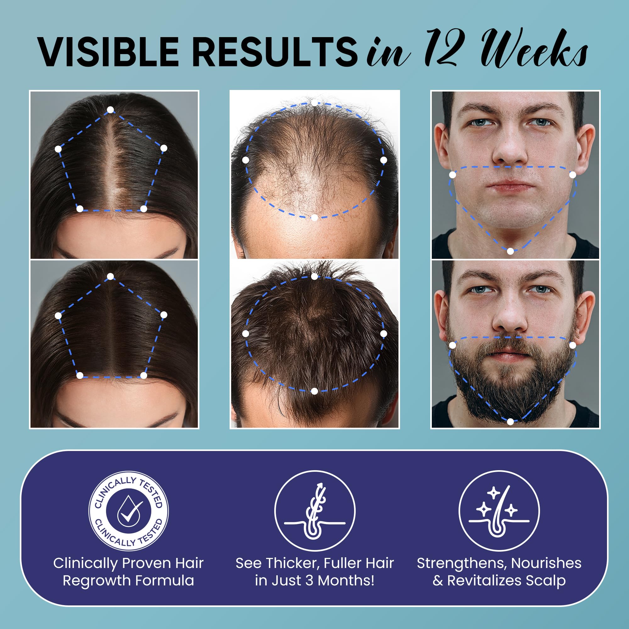 OLIVITA Minoxidil spray mist demonstrates fast-drying, non-greasy formula for daily routine convenience.