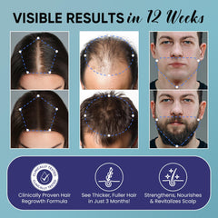 OLIVITA Minoxidil spray mist demonstrates fast-drying, non-greasy formula for daily routine convenience.