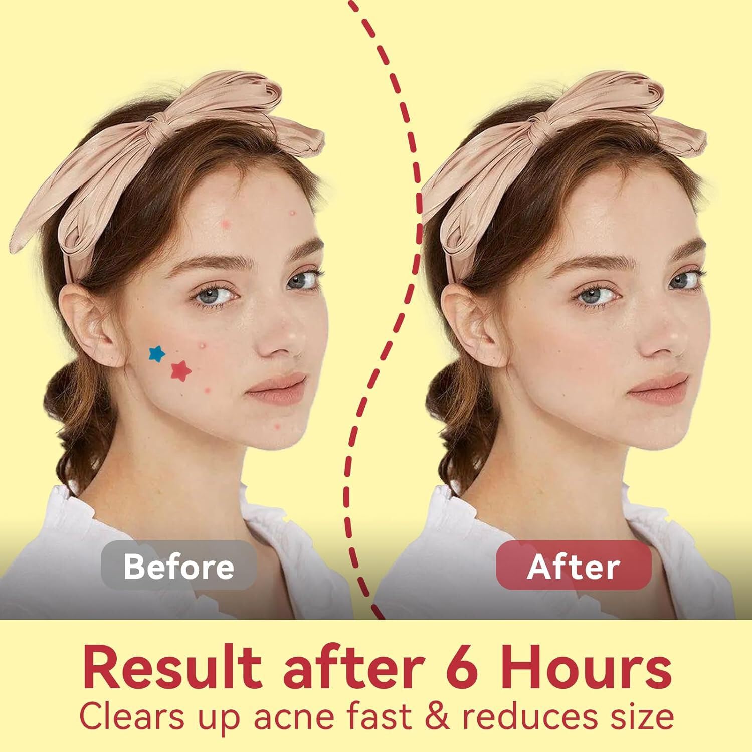 OMADOTO patches stay in place during day and night.