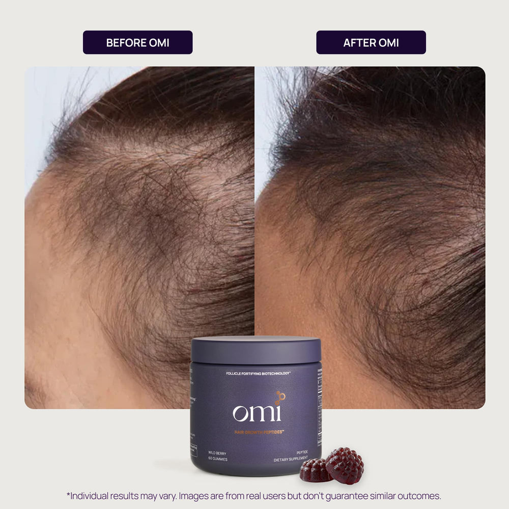 OMI WELLBEAUTY gummies beside hair strands illustration showing growth