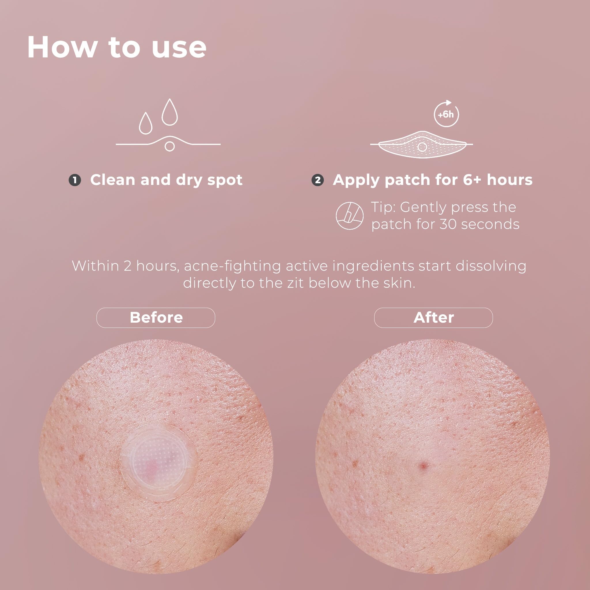 OMMA ingredients include salicylic acid and tea tree.