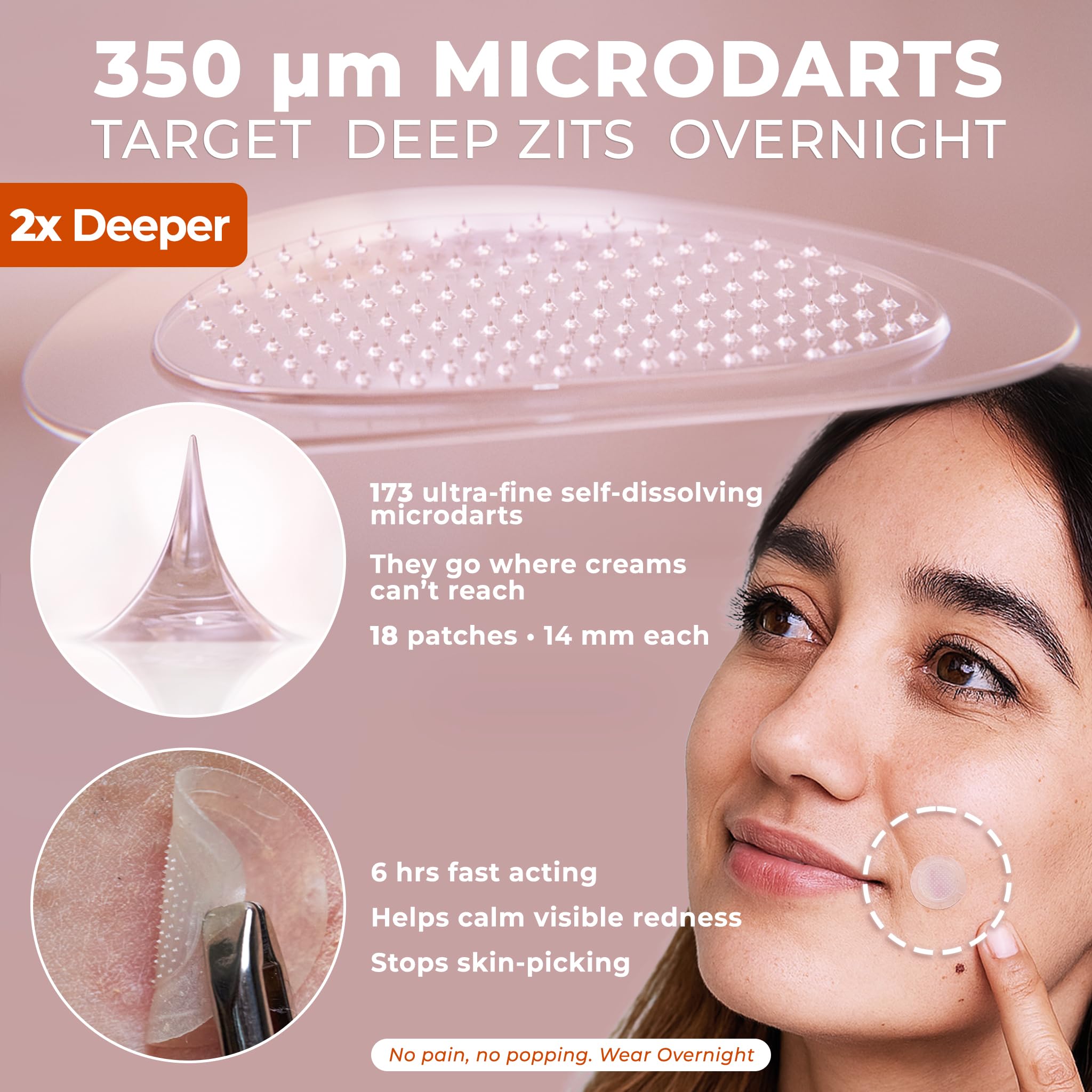 OMMA Korean micropoint patch closeup reveals 420 microcrystals.