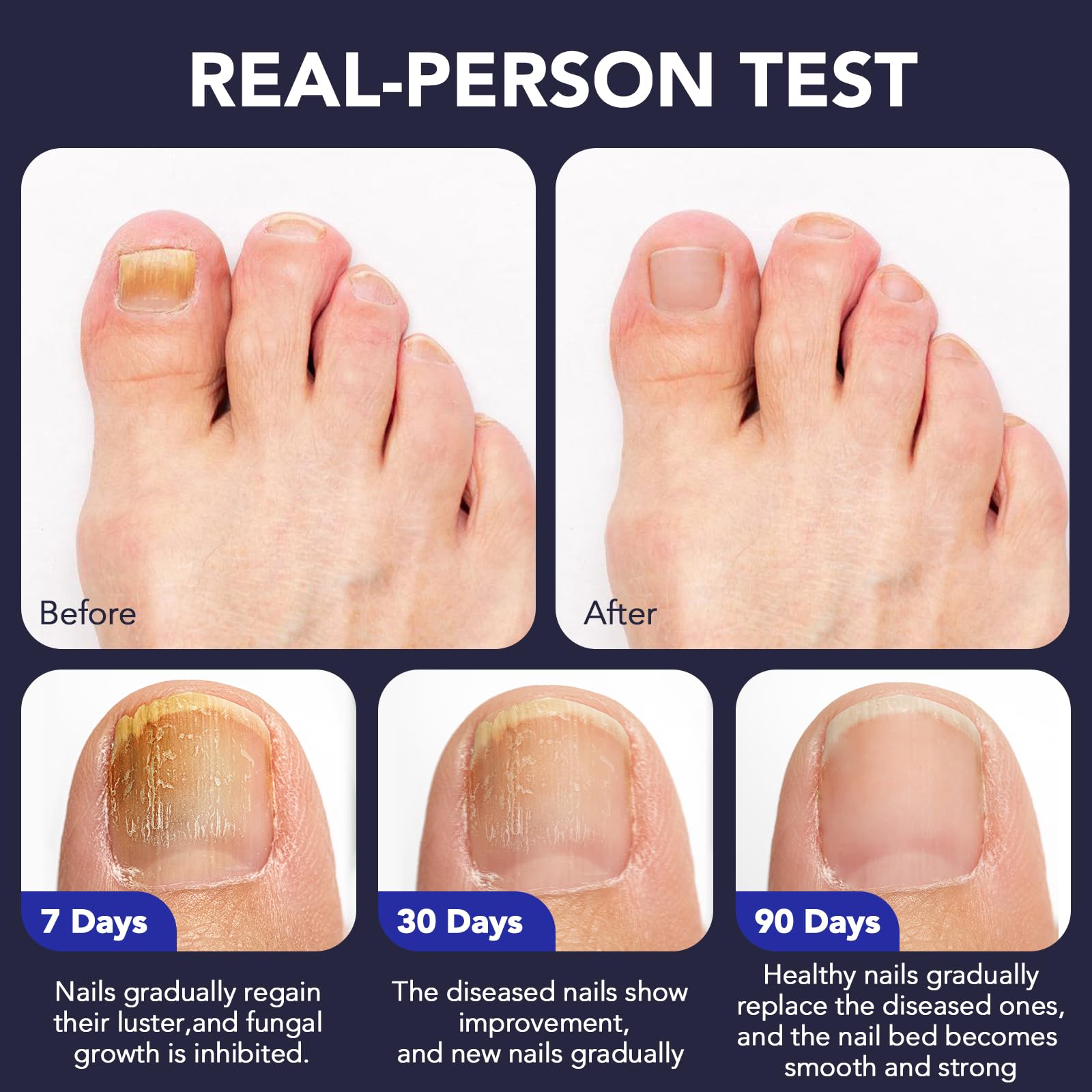 OMZOK athlete-friendly nail treatment ready for active lifestyles.