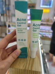 Onkessy acne treatment gel application demonstrates fast-absorbing, lightweight texture
