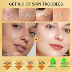 Onkessy Skin Care Set eye cream jar minimizes puffiness and fine lines.