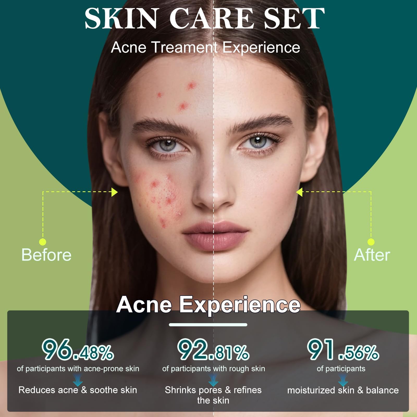 Onkessy Tea Tree Eye Cream nourishes the delicate under-eye area.