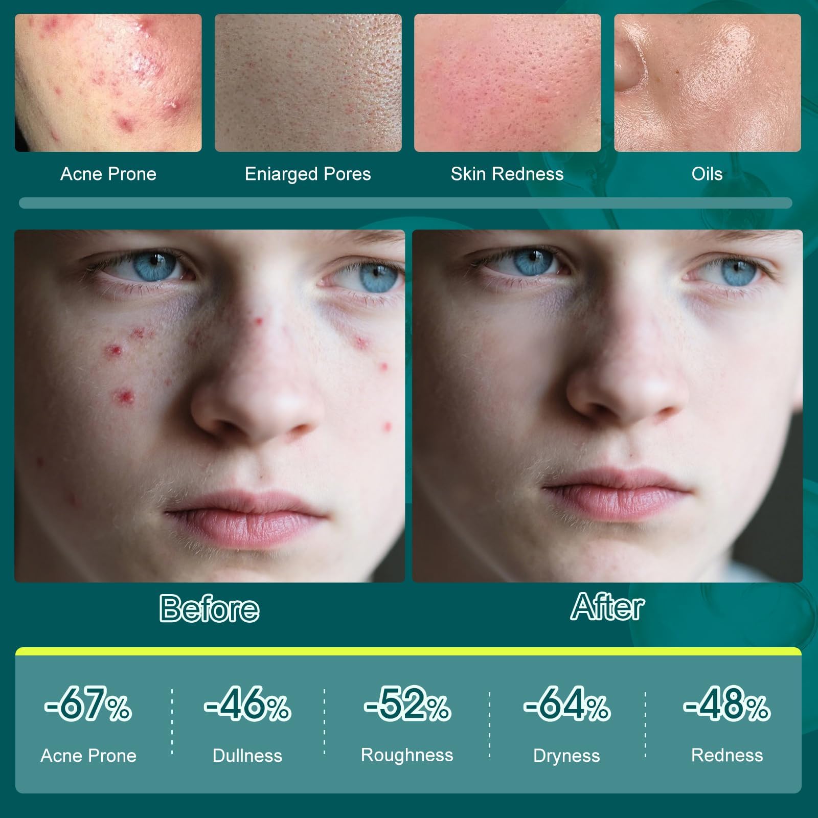 Onkessy Tea Tree Facial Cream locks in moisture for a smooth complexion.