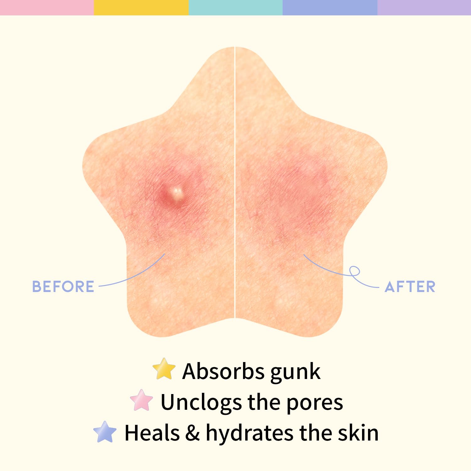 The #OOTD star patches can be worn overnight to protect a blemish.