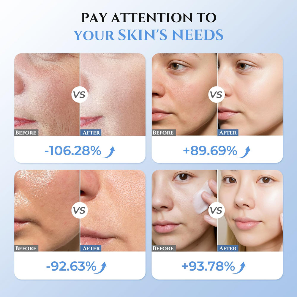 Oranmagic orange-light therapy targets puffiness and contour enhancement.
