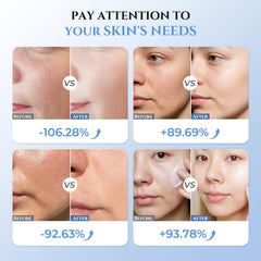 Oranmagic orange-light therapy targets puffiness and contour enhancement.