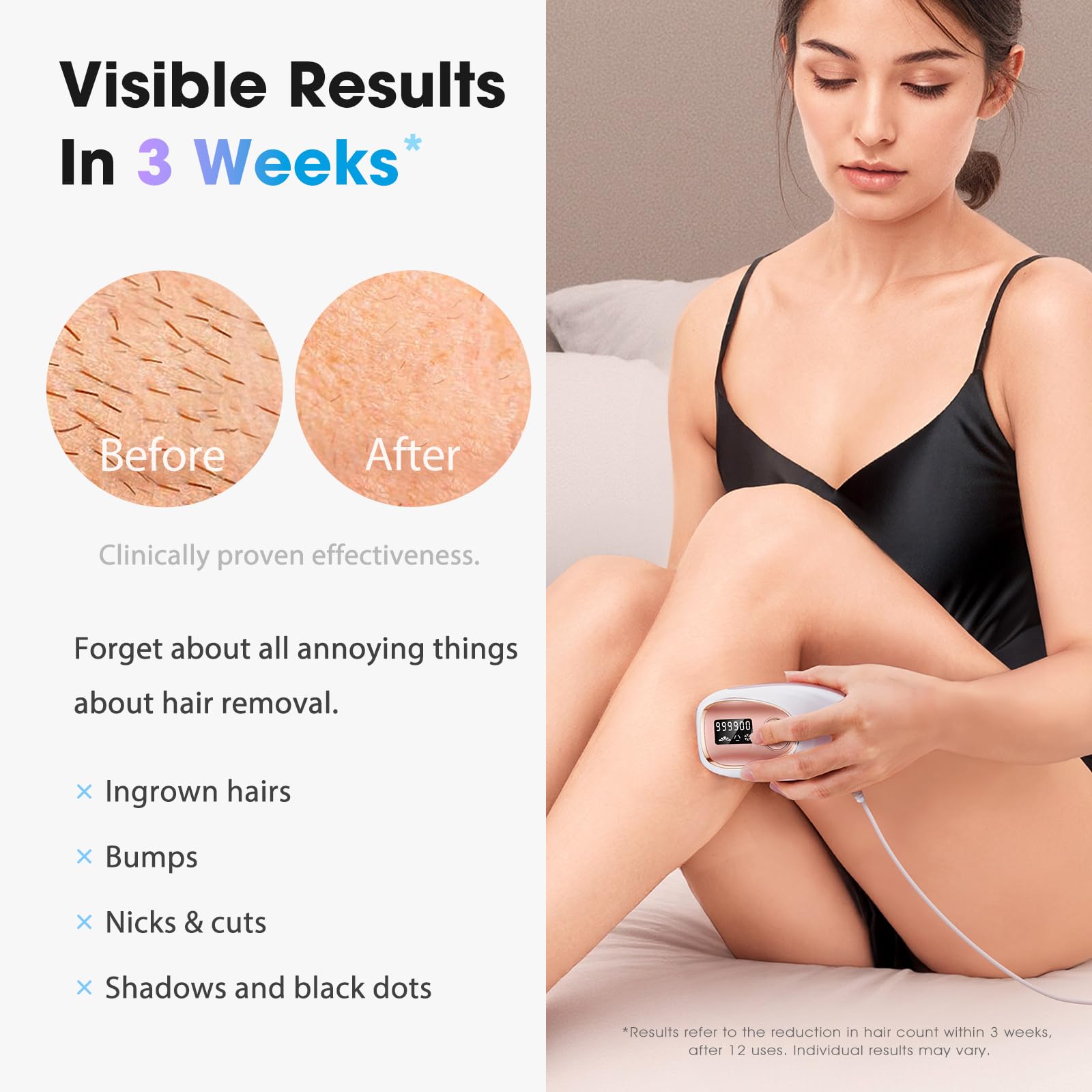 Ice-cooling plate keeps skin comfortable during sessions for calmer, smoother results