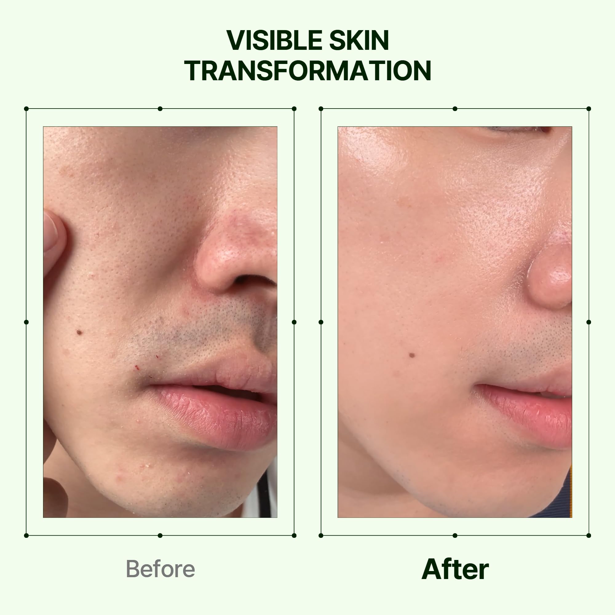 Orien Mugwort Collagen Pore Serum on a clean surface suggests a light glide.