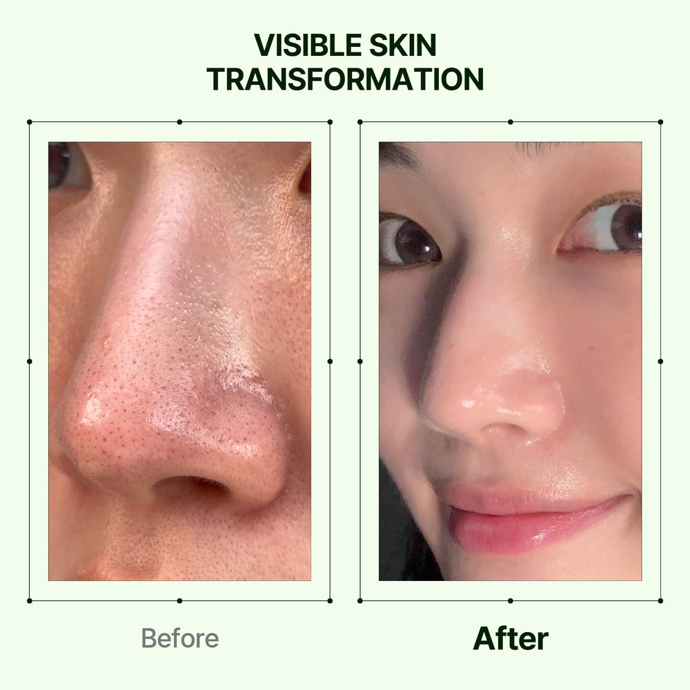 Orien Mugwort Zero Film Cleansing Oil mugwort and centella ingredients soothe skin.