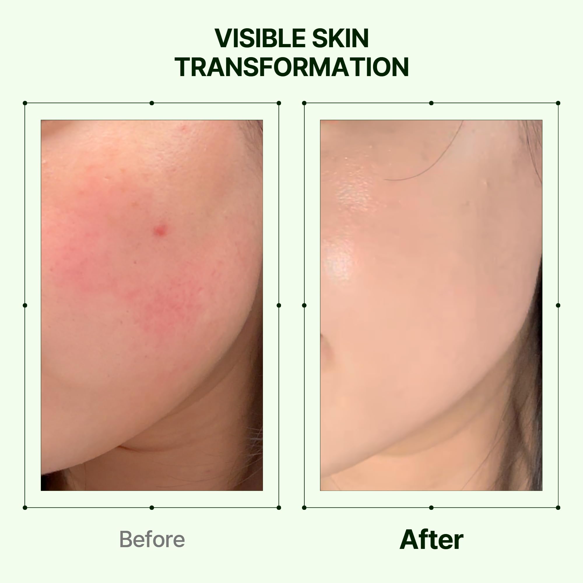 Orien Mugwort Zero Film Moisturizer provides hydration for long-lasting comfort