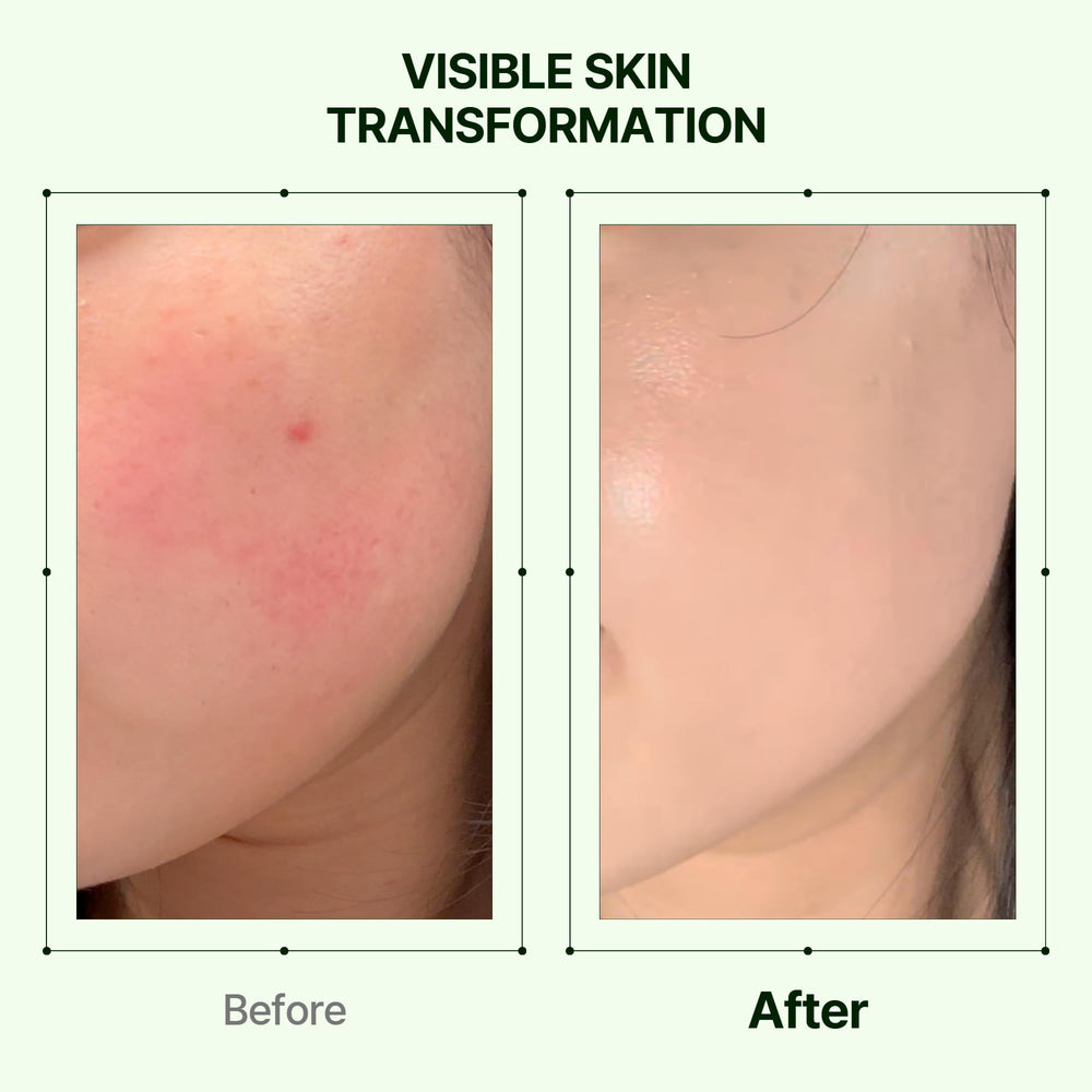 Orien Mugwort Zero Film Moisturizer provides hydration for long-lasting comfort