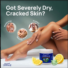 Original Udder Balm in hand demonstrates daily use for dry hands.