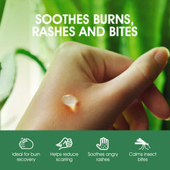 ORISO Aloe Vera Gel provides natural sunburn relief after sun exposure