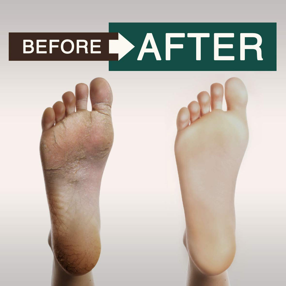 Gentle cleansing with ORISO Tea Tree Oil Body Wash promoting skin care benefits.