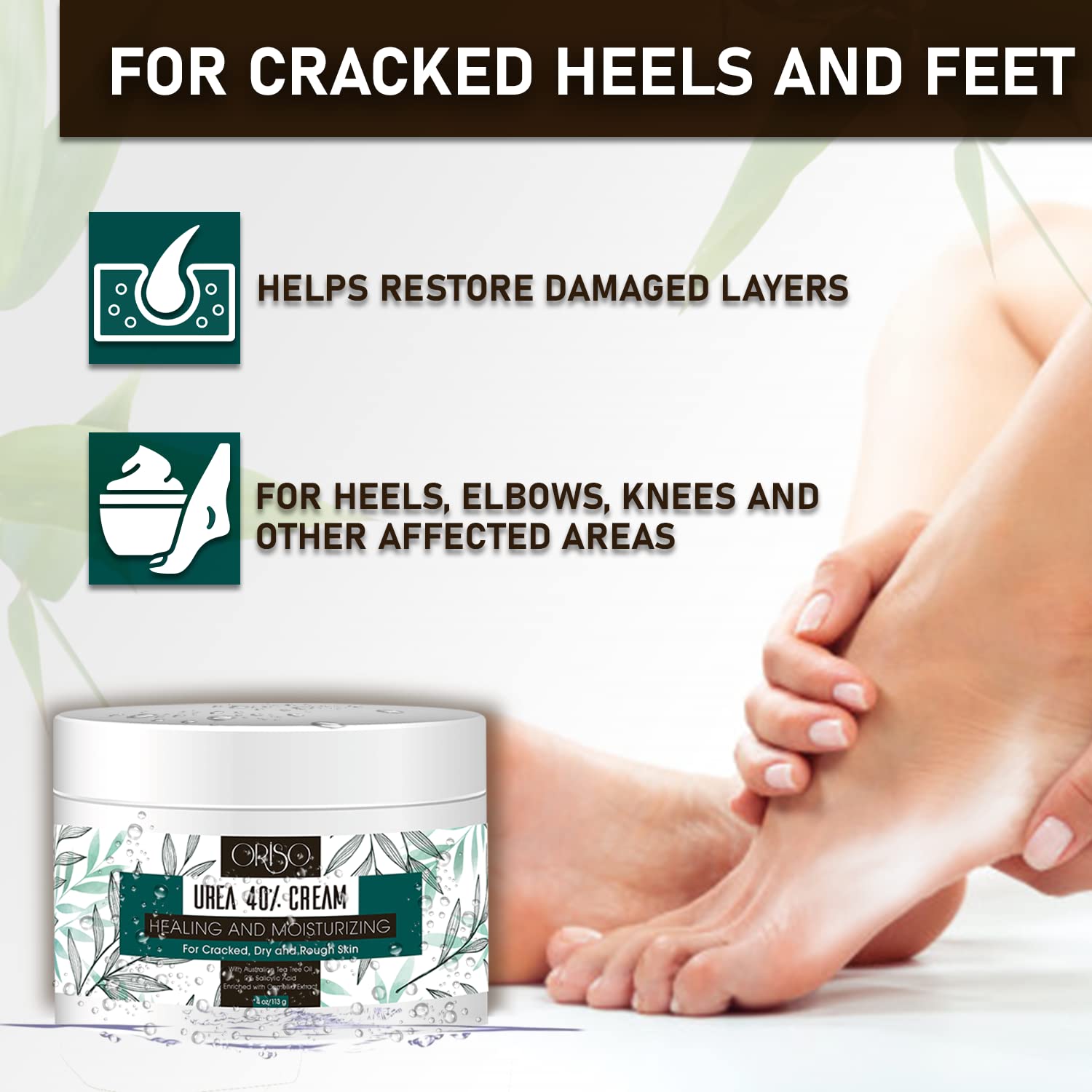 ORISO Urea Cream 40% hand callus targets rough palms with salicylic acid exfoliation.