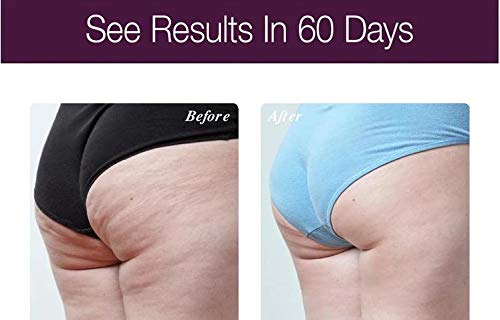 Osmotics Cosmeceuticals Anti-Aging Body Lift belly area smoother texture.