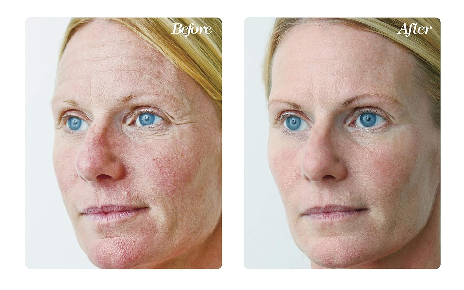 Osmotics Blue Copper 5 bottle label emphasizing premium peptide formula.