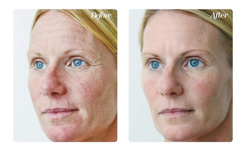 Osmotics Blue Copper 5 bottle label emphasizing premium peptide formula.