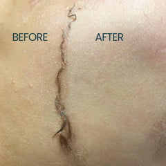 Ouiloe Dermaplane Oil applied on the face for smooth shaving glide.