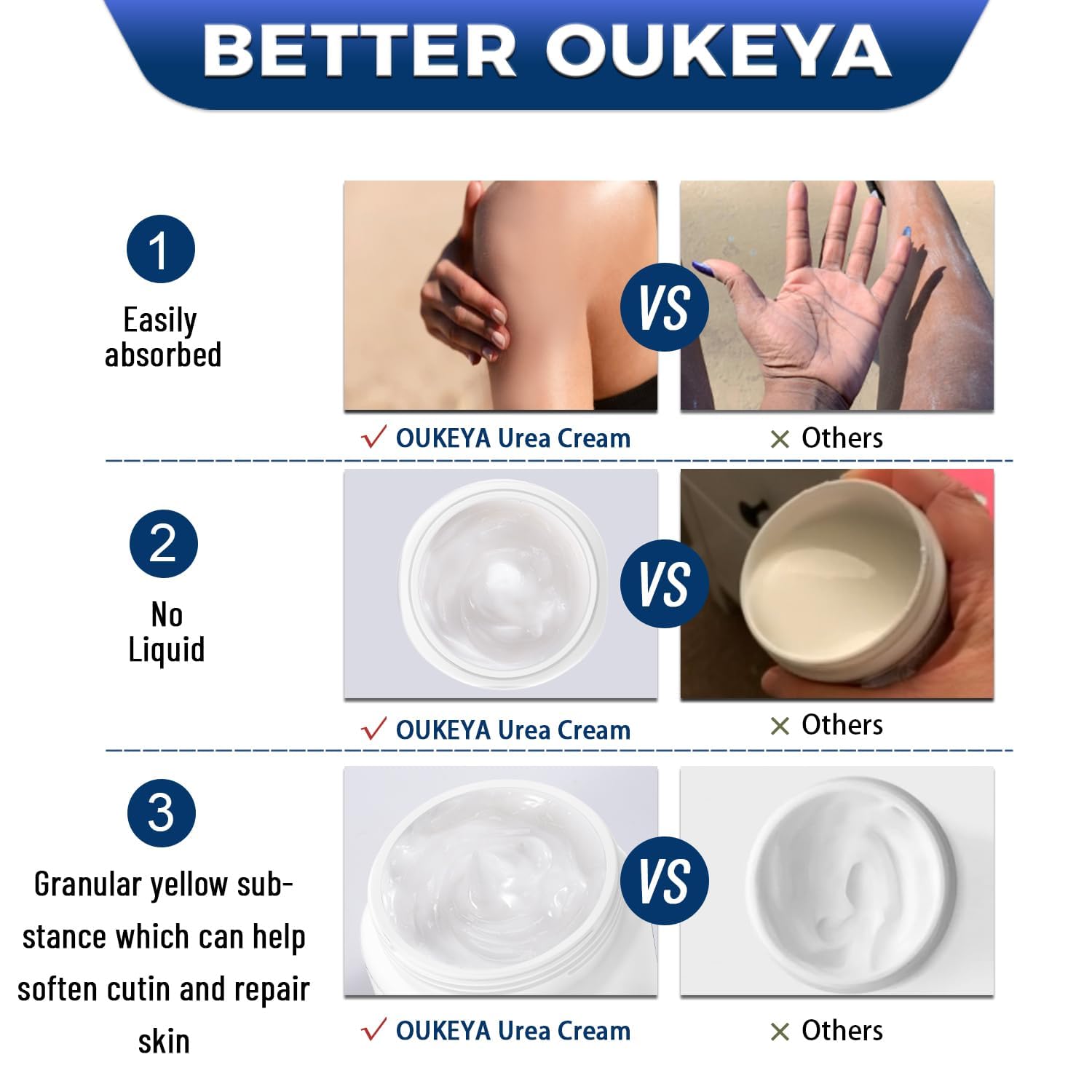OUKEYA Urea Cream 40% texture closeup reveals creamy moisture
