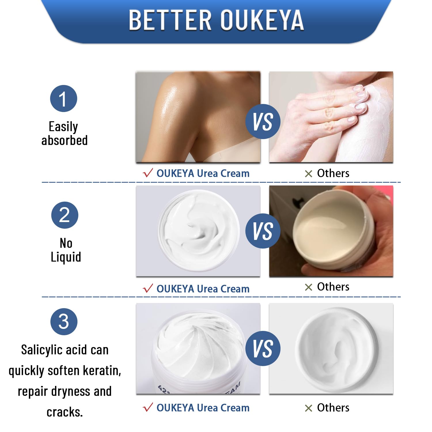 OUKEYA urea cream 42% on hand showing quick-absorption finish.